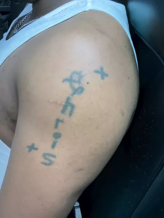 A faded blue name tattoo with small crosses on a shoulder, before any new work went over it